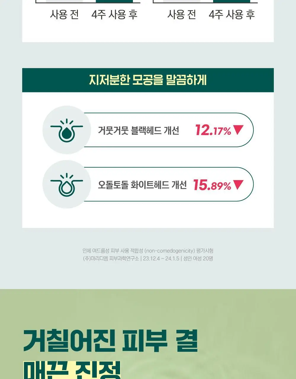 [집중진정] 라운드랩 포 맨 소나무 진정 토너/크림 2종 기획 (+클렌저 40ml or 토너 300ml 기획) 상세페이지 33